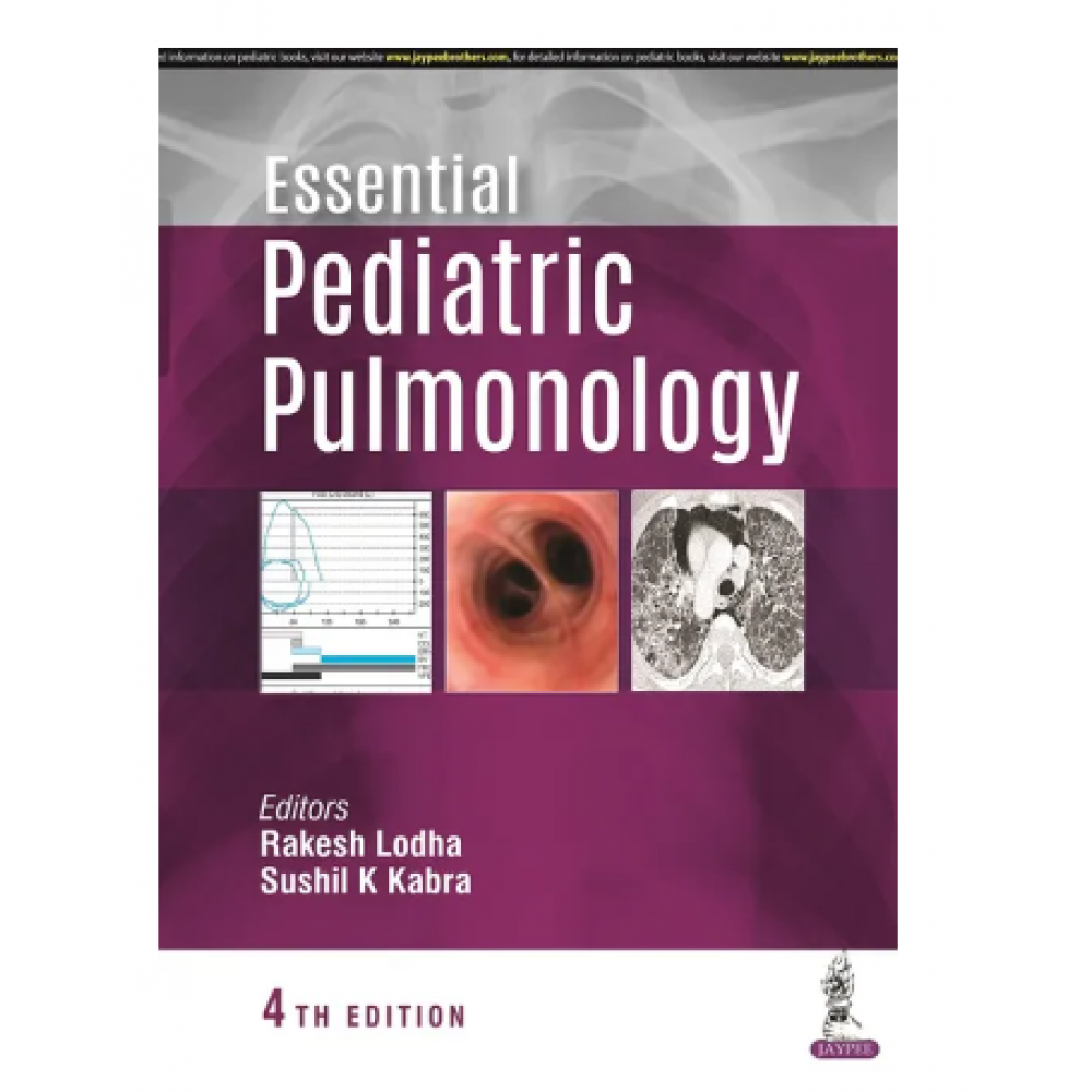 Essential Pediatric Pulmonology;4th Edition 2023 By Rakesh Lodha ...